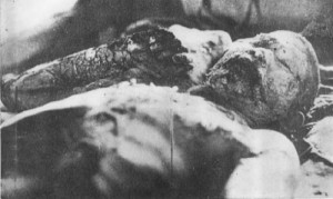 japanese-atomic-bomb-victims-34